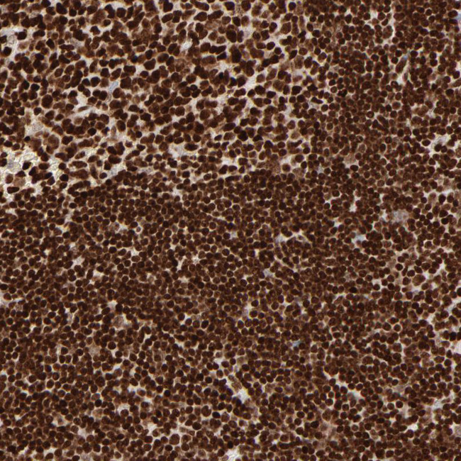 HMGB2 Antibody in Immunohistochemistry (Paraffin) (IHC (P))