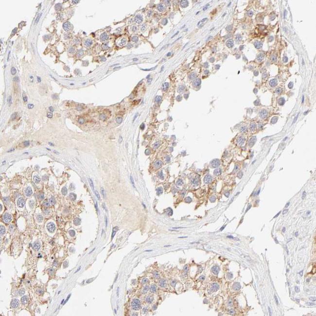 MTERFD3 Antibody in Immunohistochemistry (Paraffin) (IHC (P))