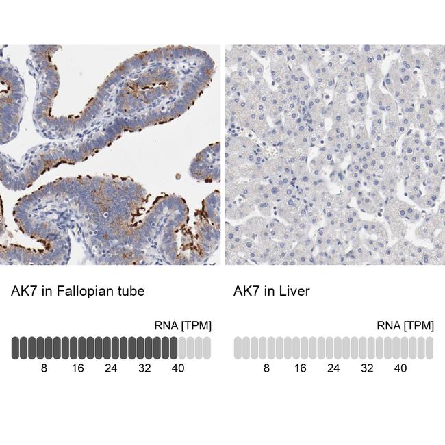 Adenylate Kinase 7 Antibody in Immunohistochemistry (IHC)