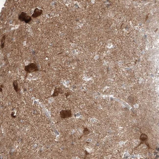 Amisyn Antibody in Immunohistochemistry (IHC)