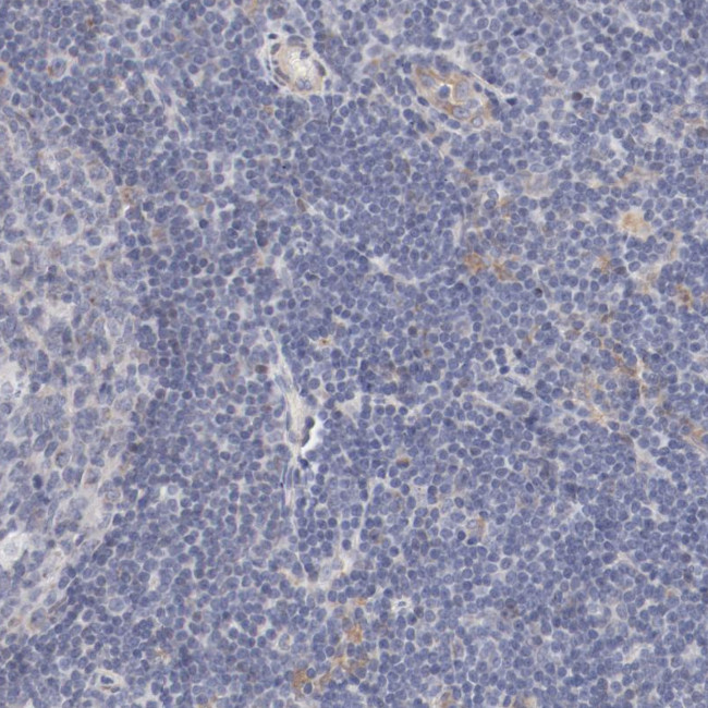 MAGED4 Antibody in Immunohistochemistry (Paraffin) (IHC (P))