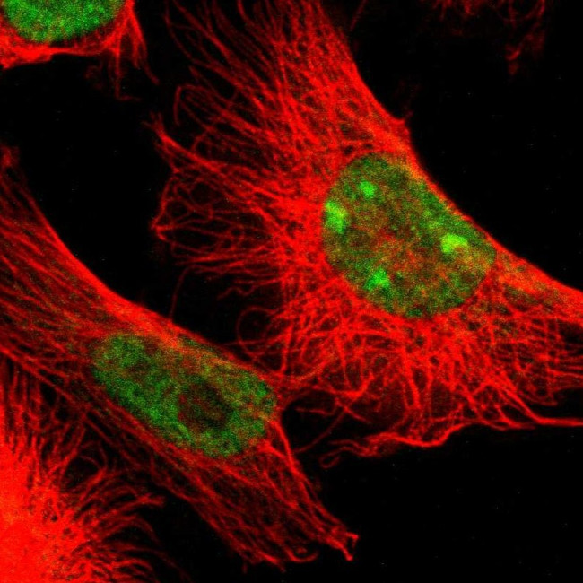 ADAR Antibody in Immunocytochemistry (ICC/IF)