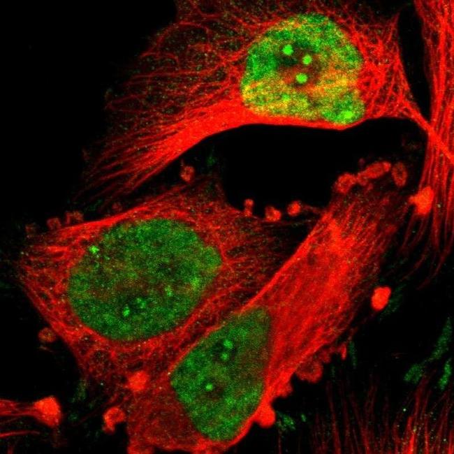 NFIB Antibody in Immunocytochemistry (ICC/IF)