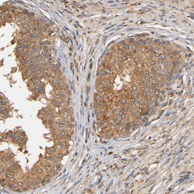 PKN1 Antibody in Immunohistochemistry (Paraffin) (IHC (P))