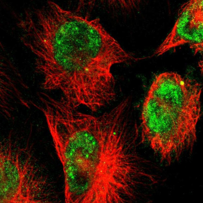 ZNF222 Antibody in Immunocytochemistry (ICC/IF)