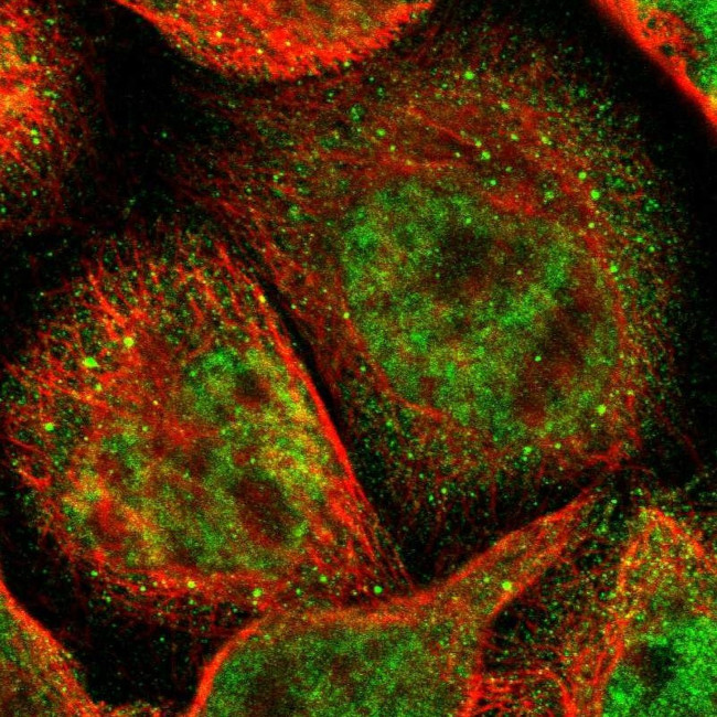 ACSS2 Antibody in Immunocytochemistry (ICC/IF)