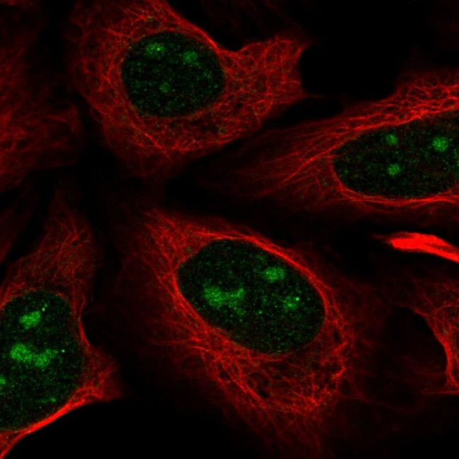 NOVA1 Antibody in Immunocytochemistry (ICC/IF)