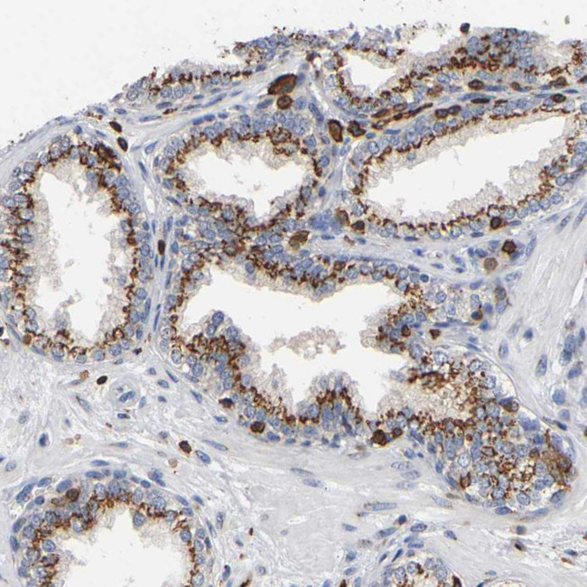 Calpain 10 Antibody in Immunohistochemistry (Paraffin) (IHC (P))