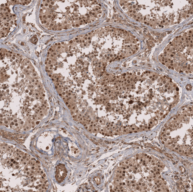 ZNF473 Antibody in Immunohistochemistry (Paraffin) (IHC (P))