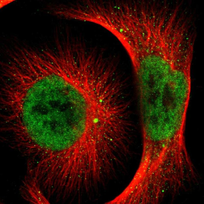 NCOA6 Antibody in Immunocytochemistry (ICC/IF)