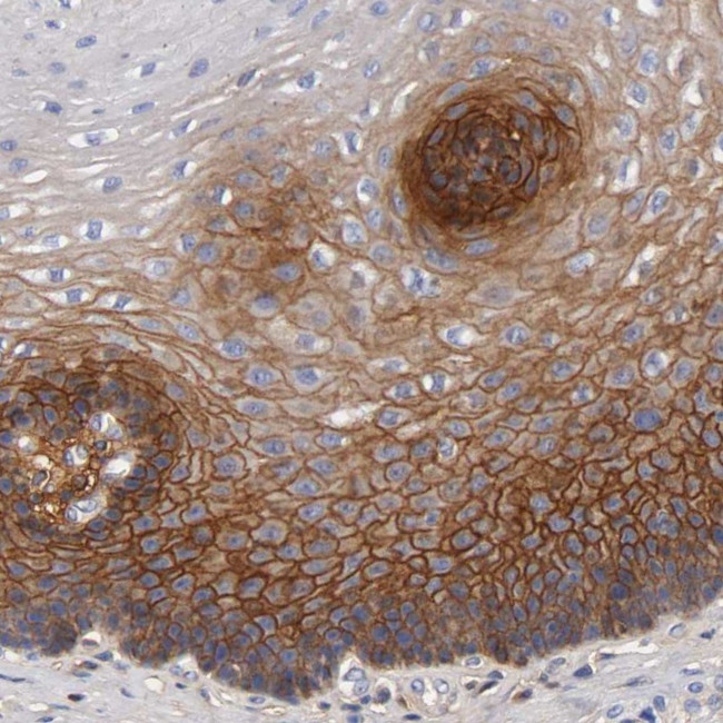 FGFBP1 Antibody in Immunohistochemistry (Paraffin) (IHC (P))