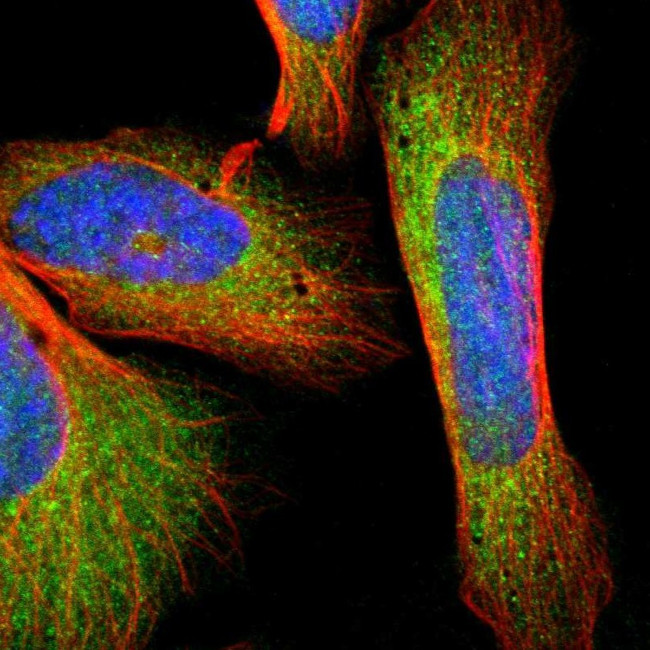 GSTZ1 Antibody in Immunocytochemistry (ICC/IF)