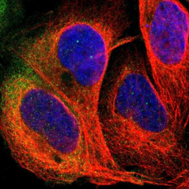 PDE5 Antibody in Immunocytochemistry (ICC/IF)