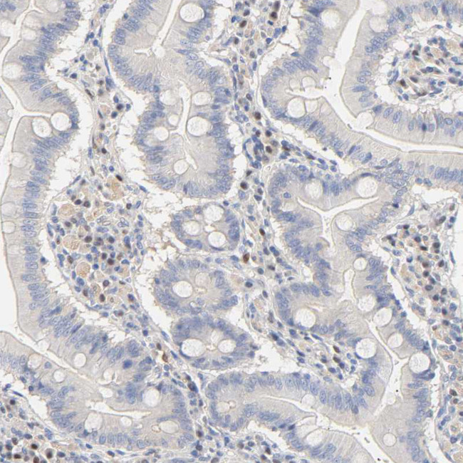 MEF2B Antibody in Immunohistochemistry (Paraffin) (IHC (P))