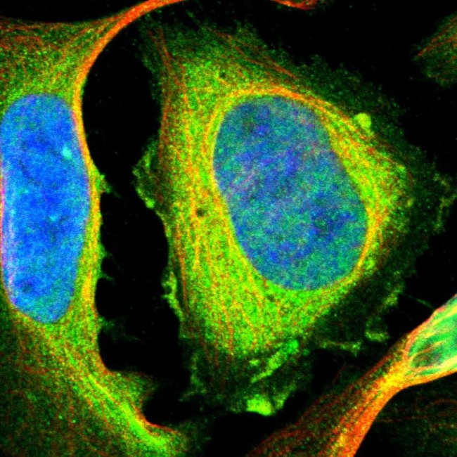 Filamin B Antibody in Immunocytochemistry (ICC/IF)