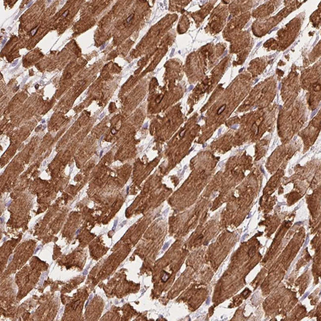 HRC Antibody in Immunohistochemistry (Paraffin) (IHC (P))