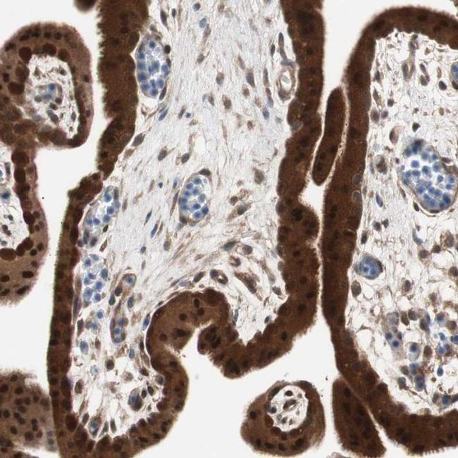 GALT Antibody in Immunohistochemistry (IHC)