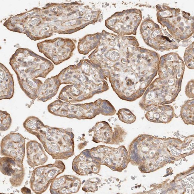 PTPN22 Antibody in Immunohistochemistry (Paraffin) (IHC (P))