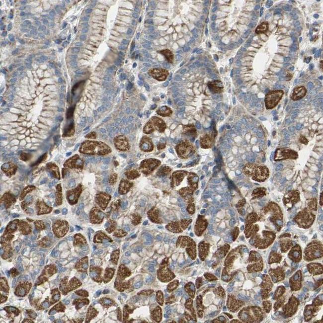 FMN1 Antibody in Immunohistochemistry (IHC)