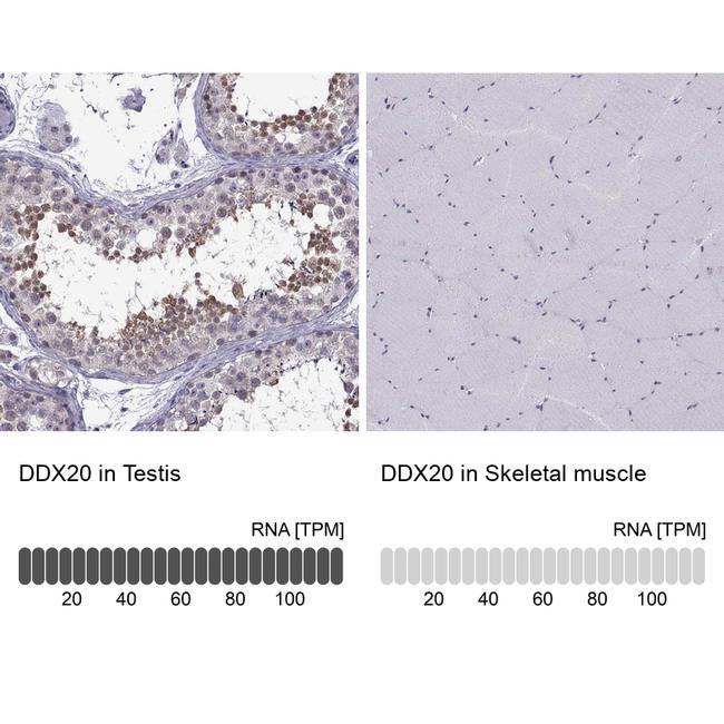 Gemin 3 Antibody in Immunohistochemistry (IHC)