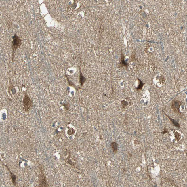 KANK1 Antibody in Immunohistochemistry (Paraffin) (IHC (P))