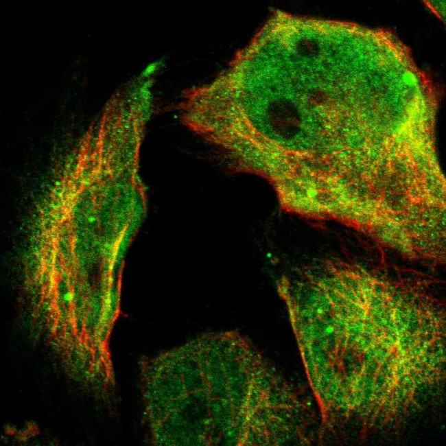 SKAP2 Antibody in Immunocytochemistry (ICC/IF)