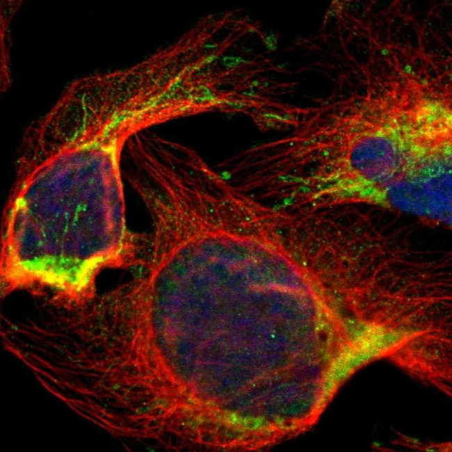 PRELID1 Antibody in Immunocytochemistry (ICC/IF)