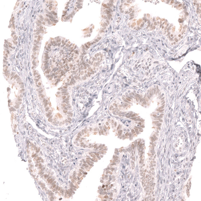 TRIP13 Antibody in Immunohistochemistry (Paraffin) (IHC (P))