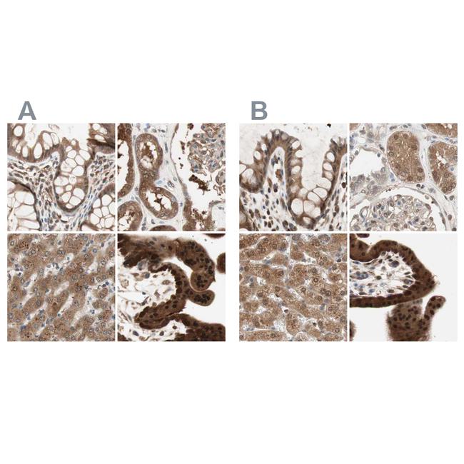 GALT Antibody in Immunohistochemistry (IHC)