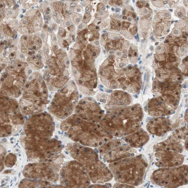 GART Antibody in Immunohistochemistry (Paraffin) (IHC (P))