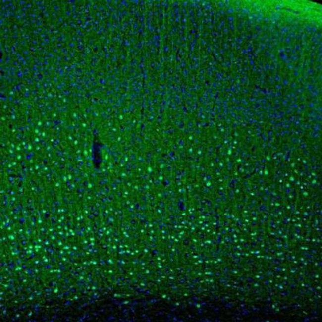 PCP4 Antibody in Immunohistochemistry (IHC)