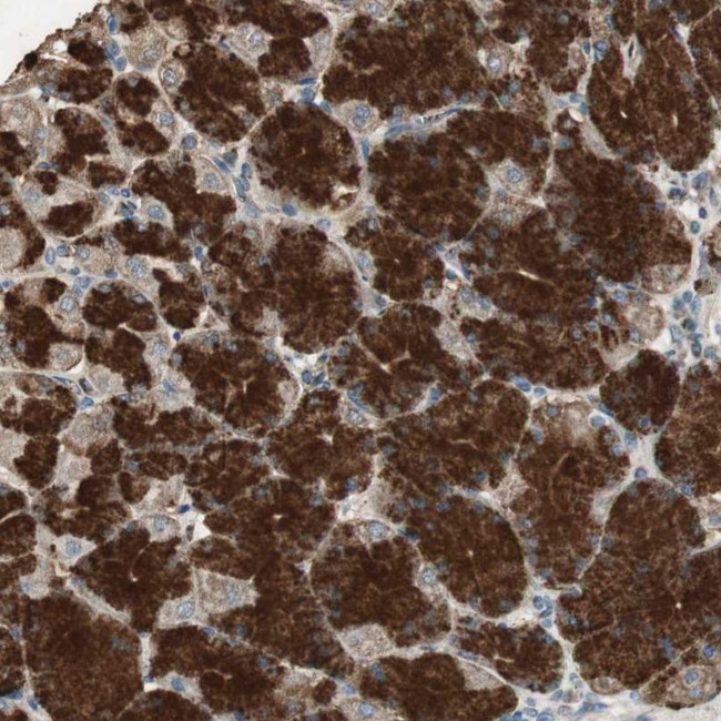 MSTO1 Antibody in Immunohistochemistry (Paraffin) (IHC (P))