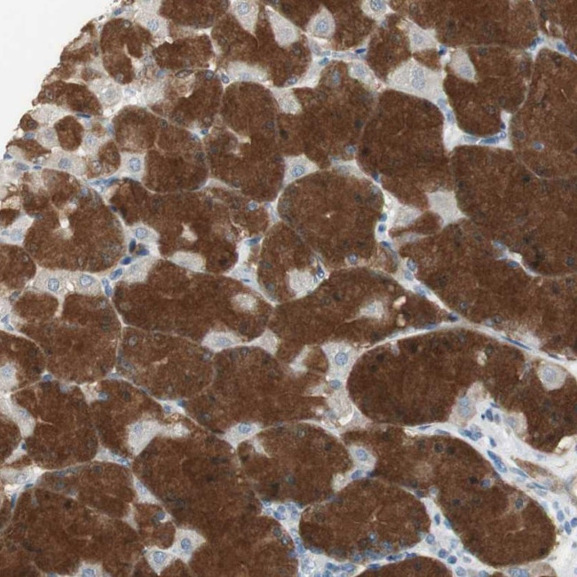 MSTO1 Antibody in Immunohistochemistry (Paraffin) (IHC (P))