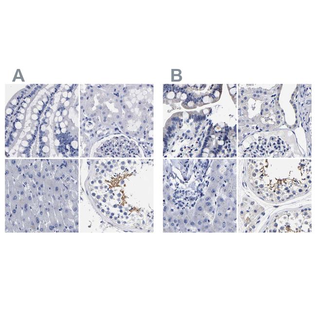 AKAP4 Antibody in Immunohistochemistry (IHC)