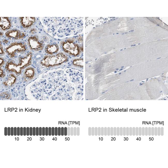 LRP2 Antibody in Immunohistochemistry (IHC)