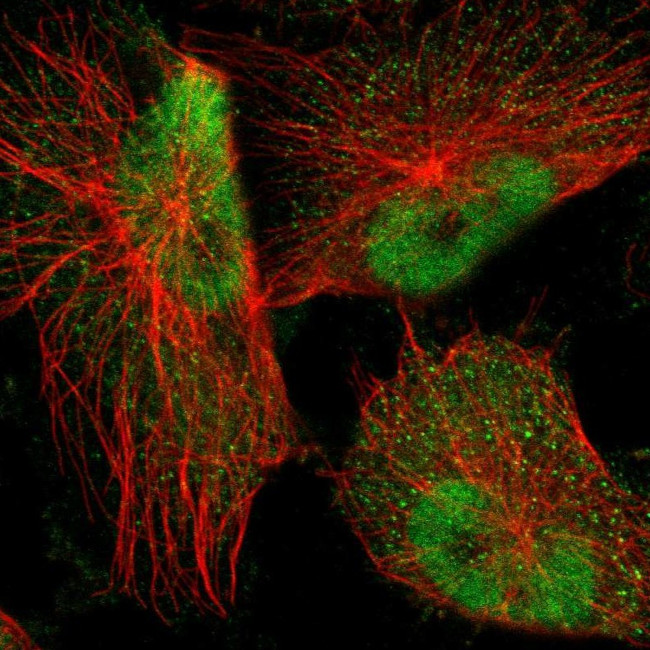 NFIA Antibody in Immunocytochemistry (ICC/IF)