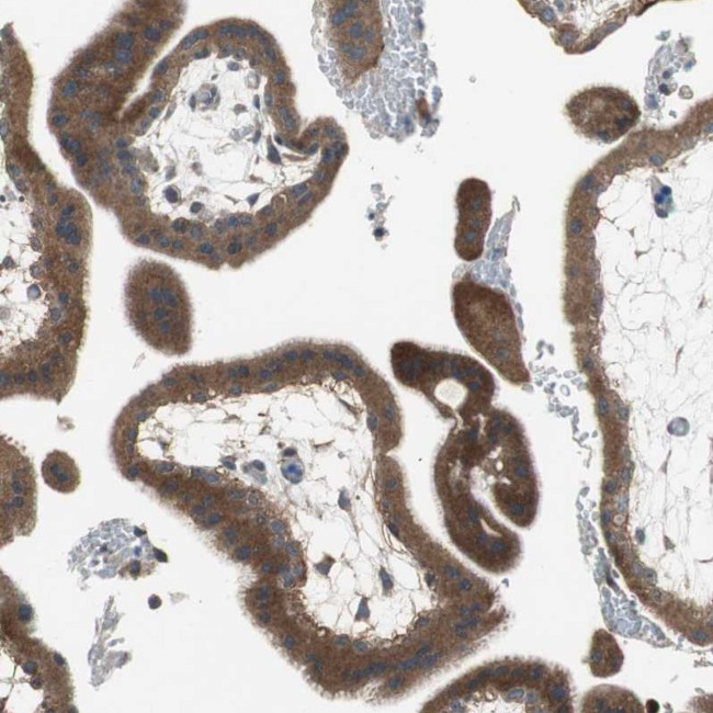 ADAMTSL4 Antibody in Immunohistochemistry (Paraffin) (IHC (P))