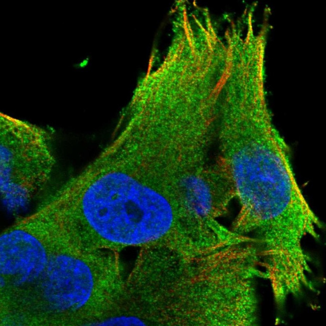 LZTS1 Antibody in Immunocytochemistry (ICC/IF)