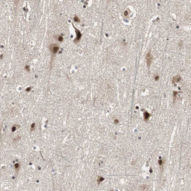 Cdc5L Antibody in Immunohistochemistry (Paraffin) (IHC (P))