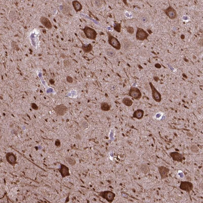 PIAS3 Antibody in Immunohistochemistry (Paraffin) (IHC (P))