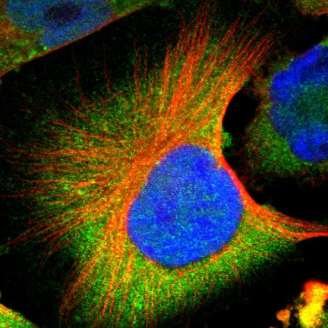 CNOT3 Antibody in Immunocytochemistry (ICC/IF)