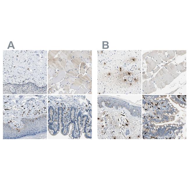 Carboxypeptidase A3 Antibody in Immunohistochemistry (IHC)