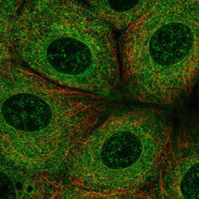 SLC27A3 Antibody in Immunocytochemistry (ICC/IF)