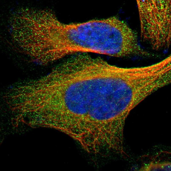 GNE Antibody in Immunocytochemistry (ICC/IF)