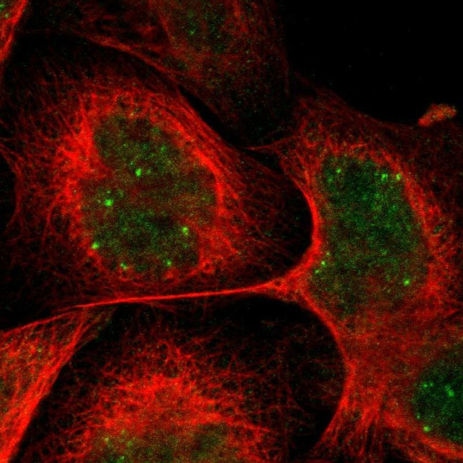 CRCP Antibody in Immunocytochemistry (ICC/IF)