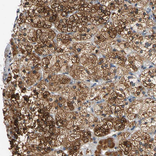 CNST Antibody in Immunohistochemistry (Paraffin) (IHC (P))