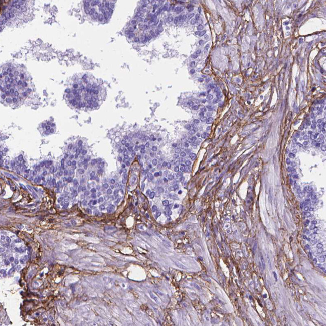 MFAP2 Antibody in Immunohistochemistry (Paraffin) (IHC (P))