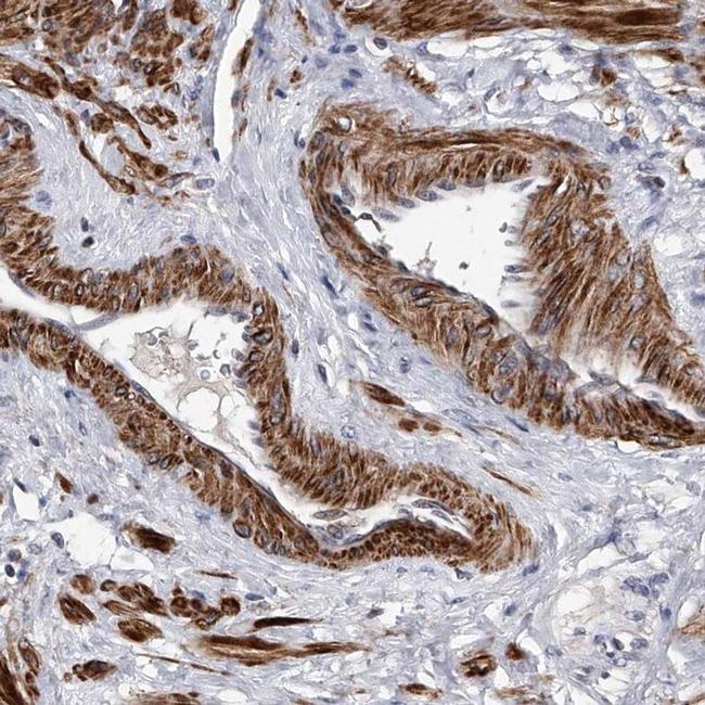 SPOCK1 Antibody in Immunohistochemistry (IHC)