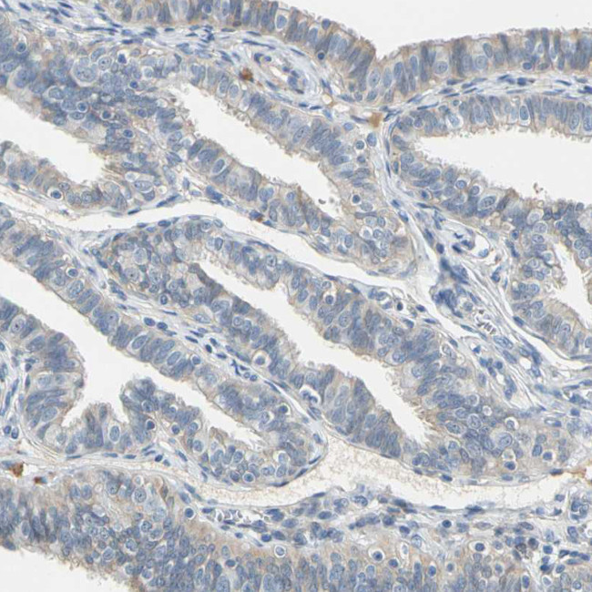 WIPI1 Antibody in Immunohistochemistry (Paraffin) (IHC (P))