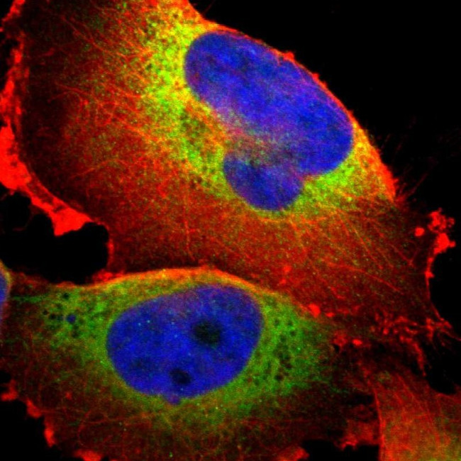 P4HA1 Antibody in Immunocytochemistry (ICC/IF)